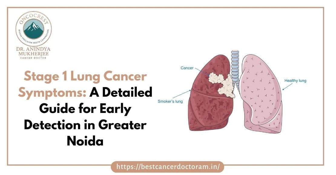 Stage 1 Lung Cancer Symptoms: A Detailed Guide for Early Detection in Greater Noida